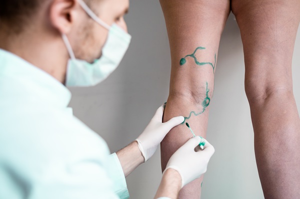 Vascular Care at CU Medicine